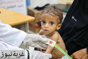 أزمة أطفال اليمن 2026: الجوع وسوء التغذية يهددان حياة الملايين