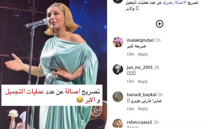 أصالة نصري تكشف مفاجآت عمليات التجميل والجمال