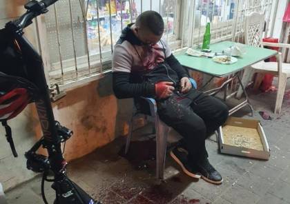 الاعلام العبري : “لقد مضى وقت طويل منذ أن رأينا مثل هذا الرعب في قلب المدن”