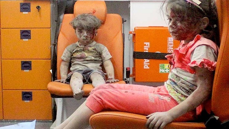 وفاة الشقيق الأكبر لطفل حلب “عمران دقنيش”