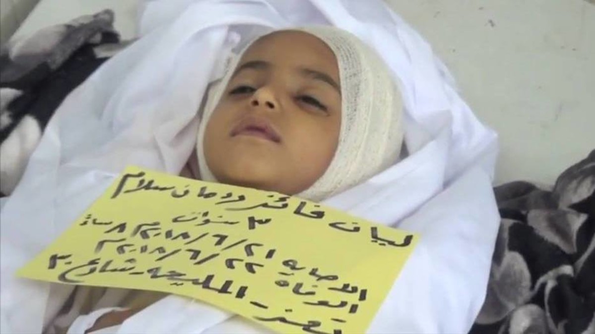 قناص حوثي يستهدف البراءة.. وطفلة الثالثة تلقى حتفها
