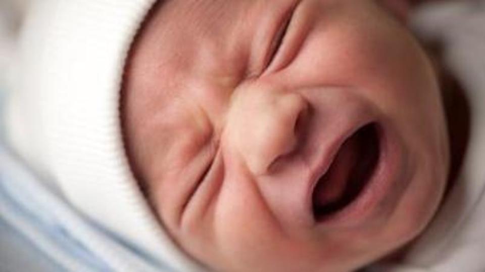 فرنسا تحقق بشأن ولادة أطفال بدون أياد ولا أذرع